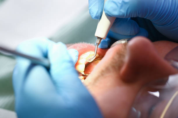 Best Emergency Root Canal Treatment in Warren, OR