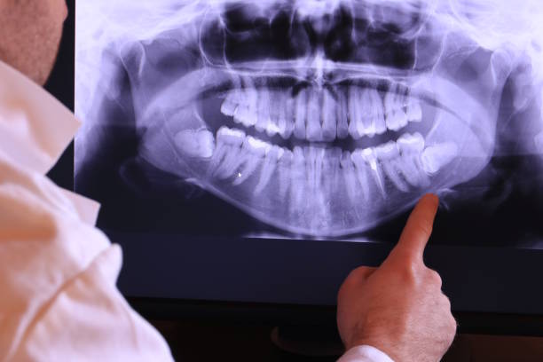 Best Urgent Care for Lost Fillings or Crowns in Warren, OR