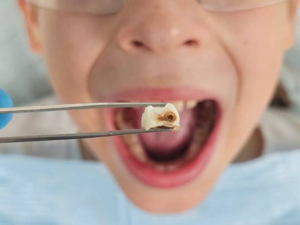 Best Emergency Denture Repair in Warren, OR